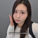 올그리드 | 강남역 피부과 올타이트리프팅 300샷 내돈내산 후기 (쳐진얼굴, 무너진 턱라인 리프팅 추천)