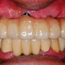 안면기공소 이미지