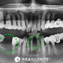 안양바른플러스치과의원 이미지