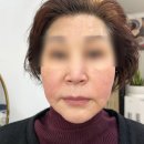 신다팩 이미지