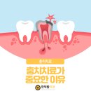 만덕탑치과의원 네이버블로그