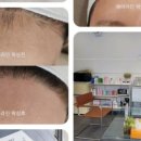 송헤어라인 - 도봉구 | 송헤어라인