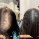 크레센트421 이미지