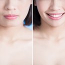 베네치아치과교정과치과의원 이미지