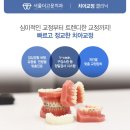 더고운치과기공소 네이버블로그