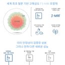 2018-03-0007 | 공모주26년04월_인벤테라 공모(상장) 후기