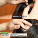 서울스페셜수면의원 | 수면다원검사 궁금하세요?? 서울 스페셜 수면의원 제공