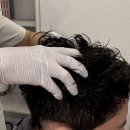감사코스메디 | 필로코스메디 신사점에서 남편 문제성두피관리 후기