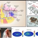 우리소리보청기 이미지
