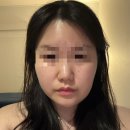 경락마사지 | 잠실 경락마사지 후기｜작은얼굴 이중턱관리 신부관리 추천 (금단비가 잠실점)