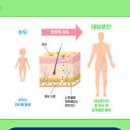 몸살 감기 목감기 통증 독감 감기 차이 이미지