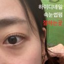 강남 압구정 하이디네일, 가성비 속눈썹펌 가격 25,000 잘하는 곳 추천