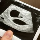 김란산부인과의원 | 두번째.감자와 눈사람 방문기(란언니 추천👍)