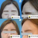 리뉴미피부과의원 이미지