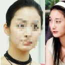 임헤어라인