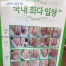 어딕션네일 | 엄지 발톱무좀 내성발톱관리 부천 어딕션네일 솔직후기