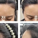 마샬헤어라인 - 달성군 | 마샬헤어라인