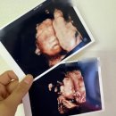 [임신22주차]곽여성병원 분만 제왕 중단으로 금빛산부인과 전원, 정밀초음파 후기