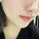 리프팅 너무 만족스러웠던 대구동성로성형외과 후기