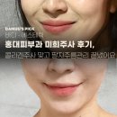 미희네 | [홍대피부과 미희주사 후기] 콜라겐주사 맞고 팔자주름관리 끝냈어요!