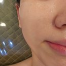 마곡피부관리 더작에스테틱에서 레이저 후 건조피부 수분관리 후기