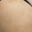 스킨52부천지부 이미지