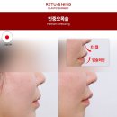 리터닝성형외과의원 이미지