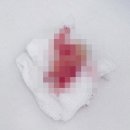 참사랑치과의원 네이버블로그