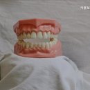 보리치과의원 네이버블로그