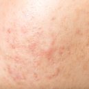 신내경희한의원 이미지