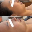 안면비대칭 전문~백의민족피부 하남미사점! 수분까지도 전문~~
