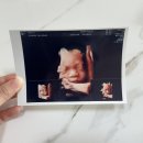 (주)부산에이스파마 | [29주~32주 임신 기록] 배 크기, 증상, 입체초음파, 백일해주사, 파마, 만삭촬영