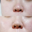 에끌라셀 | 피부재생 마스크팩 추천 에끌라셀 DRH 마스크 솔직후기