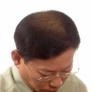 모메드솔루션 이미지