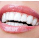 가지런이치과교정과의원 이미지