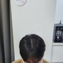 모어댄SMP | 대구 두피디자인 모어댄SMP 자연스러운 가르마 복원 진짜 잘하네
