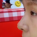 강남슈퍼 | 강남 코리프팅 잘하는곳 슈퍼하이코 시술 후기(실2줄+필러2cc)