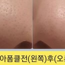지엘화장품1