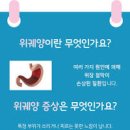 명치통증 답답함 등 명치가 아픈이유 이미지