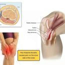 무릎 내측 통증(거위발 활액낭염) 을 위한 햄스트링 스트레칭 스탠딩 이미지