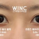 윙크 렌즈 스토어 건대입구역점 이미지