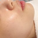 하대동309 | 진주 하대동 피부관리 아다한 트러블관리후기(ft. 루바토팻 플라즈마)