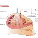 서초중앙로8길 88 | 나의 육아일기 (3) - 기형아검사
