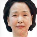 강남안성형외과의원 이미지