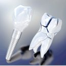 서울새로이치과의원 이미지