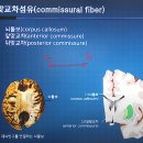 신경과학(신경해부학) 10강 백색질의 분류와 기능 White matter 이미지