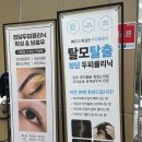 왕지5길 | 청담두피클리닉 순천법원점 탈모 관리 3회차 후기 결과 공개