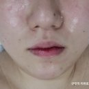 씨유 민락이편한점 | 민락동피부관리 숲칼프 민락점 윤곽관리 후기
