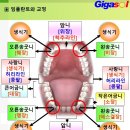 치아의 벌어짐도 오장육부의 변화~임플란트와 교정 이미지