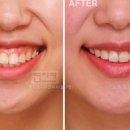 압구정연치과의원 이미지